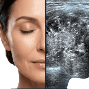 Material Teórico para el Curso de Ecografía Facial: Anatomía de Precisión, Diagnóstico de Complicaciones y Guía Intervencionista