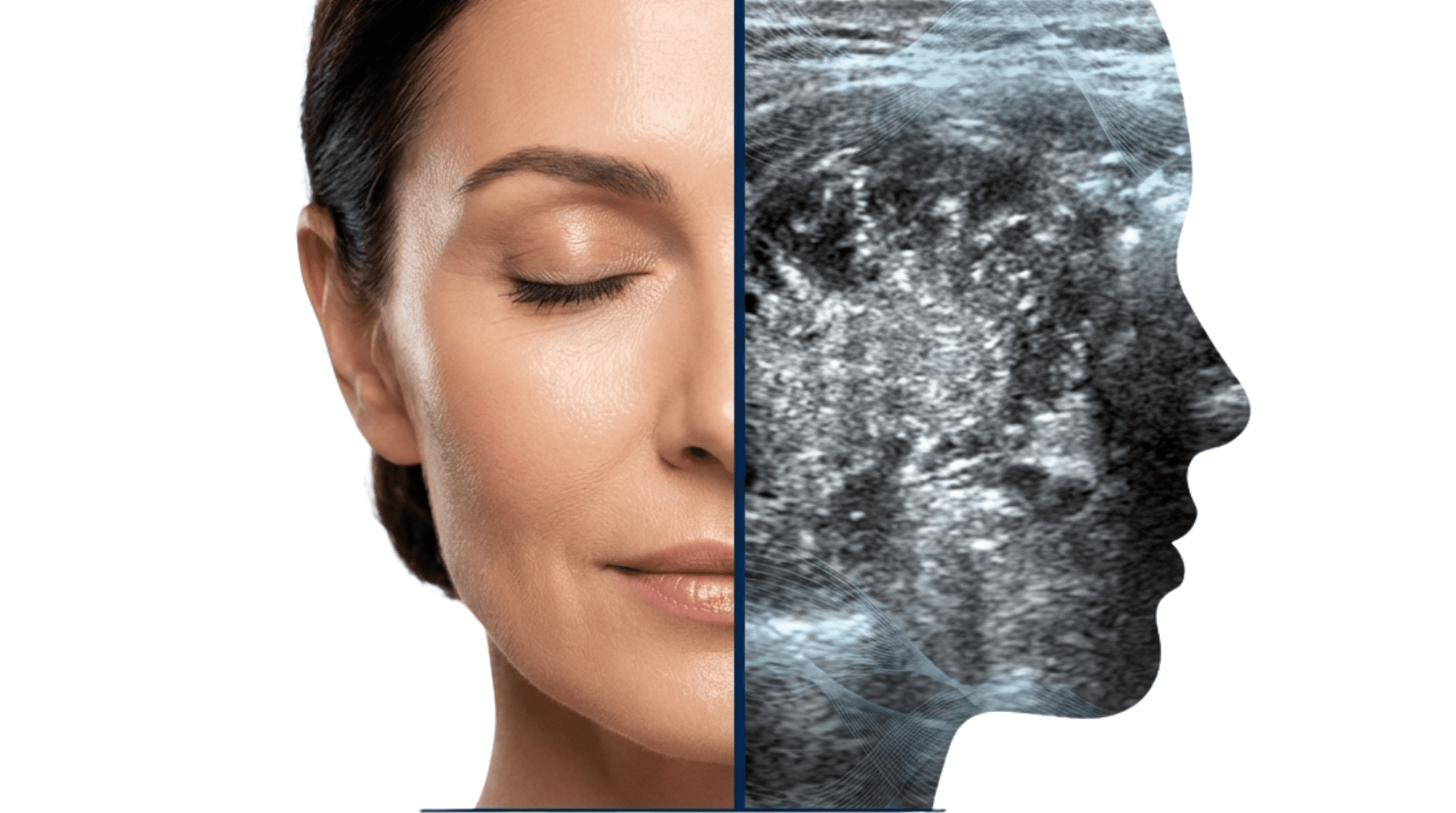 Material Teórico para el Curso de Ecografía Facial: Anatomía de Precisión, Diagnóstico de Complicaciones y Guía Intervencionista