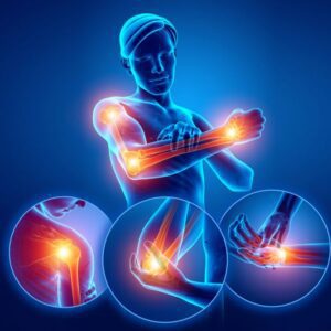 Material Teórico para el Curso de Ecografía Musculoesquelética de Miembros Superiores: Diagnóstico Dinámico y Guía Intervencionista