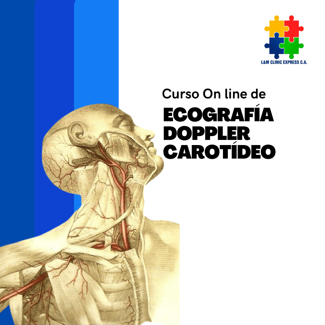 Curso On Line de Ecografia Vascular Doppler Carotídeo